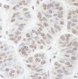 Nucleostemin Antibody, Novus Biologicals 0.1mL; Unlabeled:Antibodies, Polyclonal